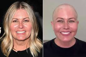 Nicole Eggert’s Brave Decision: Shaving Her Head After Breast Cancer Diagnosis