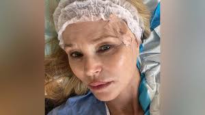 Christie Brinkley’s Skin Cancer Battle: Supermodel Reveals Diagnosis and Recovery