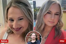 Gypsy Rose Blanchard’s Stunning Transformation: New Nose Revealed